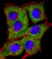 TIMP2 Antibody